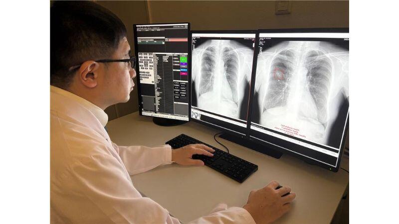 遠隔読影のイメージ